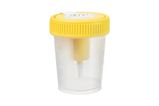 Контейнер для мочи Urine Beaker — фото 1